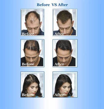 Hair Loss Treatment ESSENCE Spray