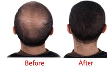 Hair Loss Treatment ESSENCE Spray